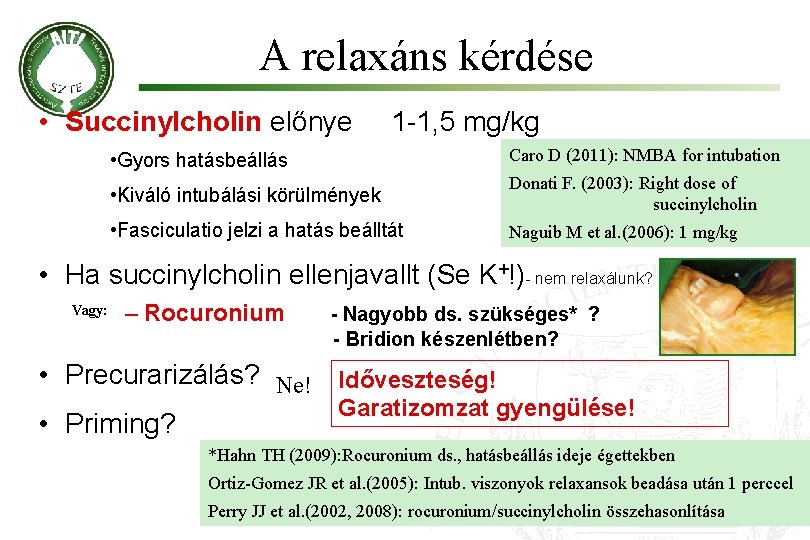 A relaxáns kérdése • Succinylcholin előnye 1 -1, 5 mg/kg • Gyors hatásbeállás Caro
