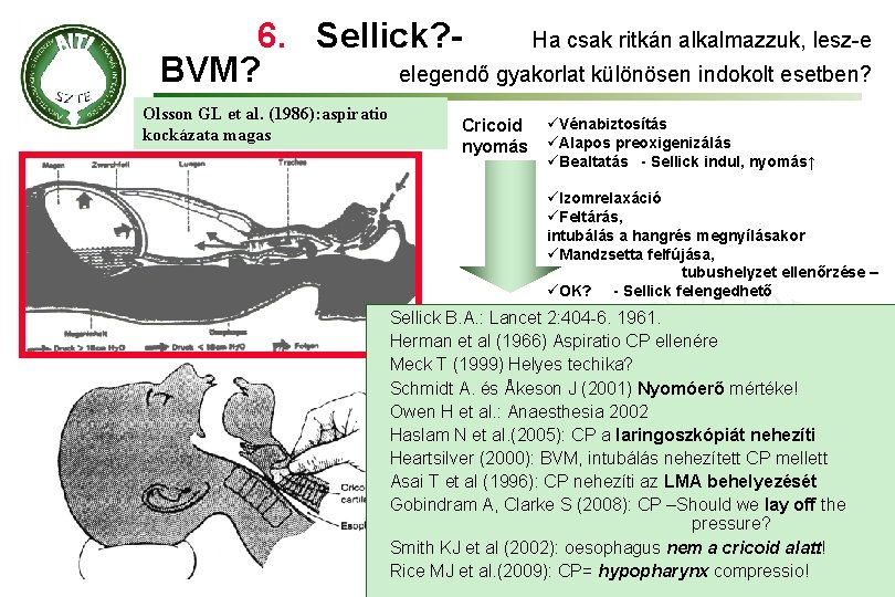 6. Sellick? Ha csak ritkán alkalmazzuk, lesz-e BVM? elegendő gyakorlat különösen indokolt esetben? Olsson