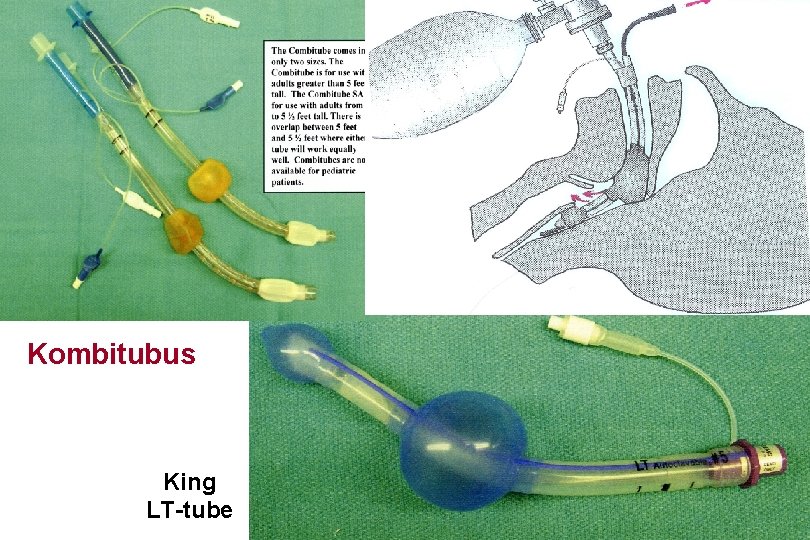Kombitubus King LT-tube 