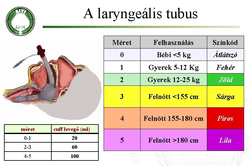A laryngeális tubus méret Méret Felhasználás Színkód 0 Bébi <5 kg Átlátszó 1 Gyerek