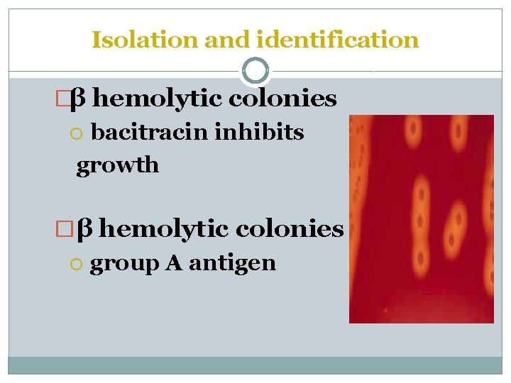 Isolation and identification �β hemolytic colonies bacitracin inhibits growth �β hemolytic colonies group A