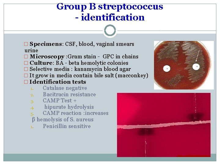 Group B streptococcus - identification � Specimens: CSF, blood, vaginal smears urine � Microscopy