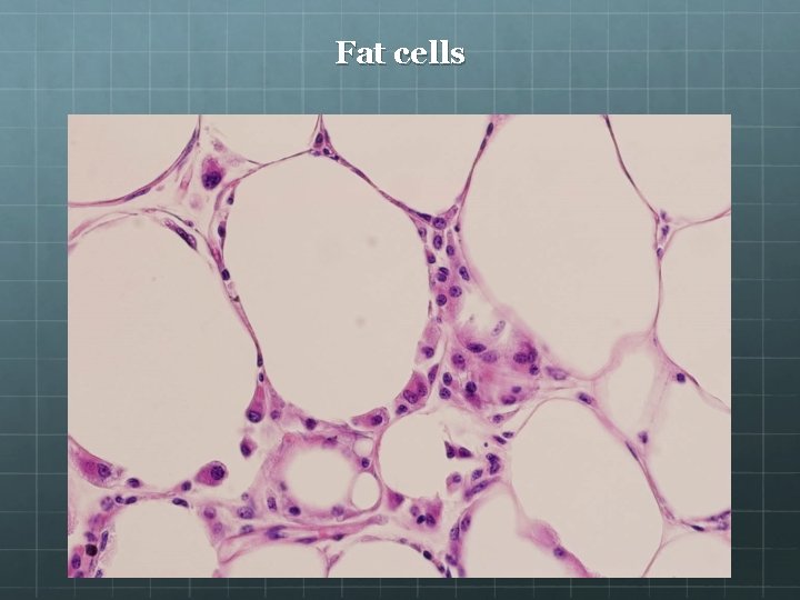 Fat cells 