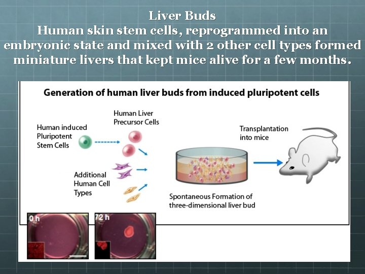 Liver Buds Human skin stem cells, reprogrammed into an embryonic state and mixed with