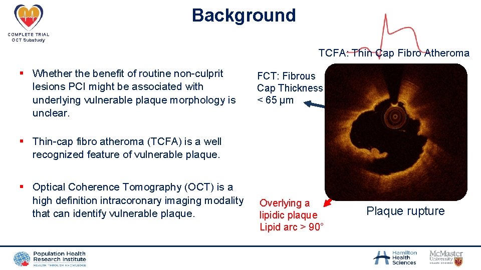 Background COMPLETE TRIAL OCT Substudy TCFA: Thin Cap Fibro Atheroma § Whether the benefit