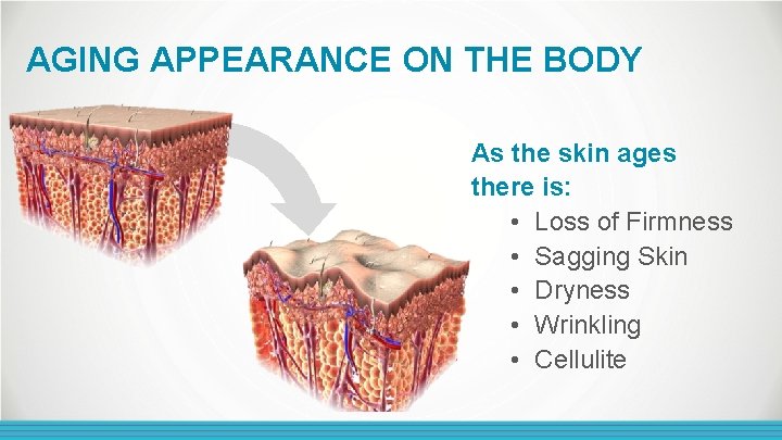 AGING APPEARANCE ON THE BODY As the skin ages there is: • Loss of