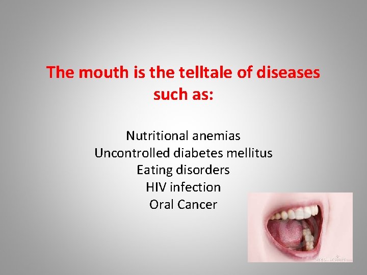 The mouth is the telltale of diseases such as: Nutritional anemias Uncontrolled diabetes mellitus