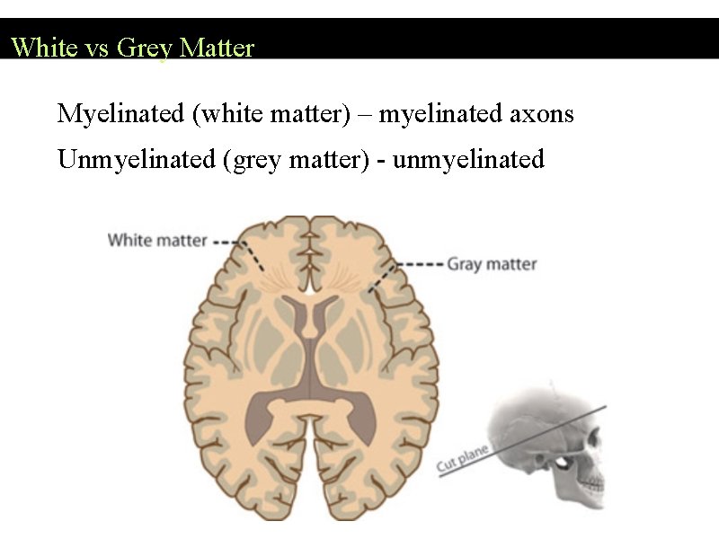 White vs Grey Matter Myelinated (white matter) – myelinated axons Unmyelinated (grey matter) -