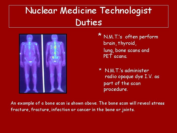 Nuclear Medicine Technologist Duties * N. M. T. ’s often perform brain, thyroid, lung,