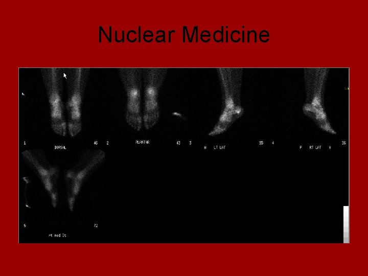 Nuclear Medicine 