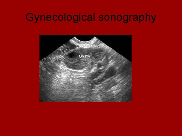 Gynecological sonography 