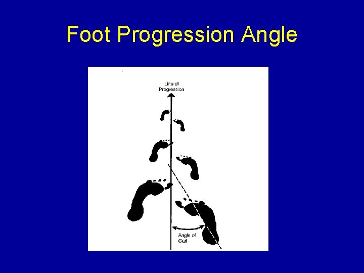 Foot Progression Angle 
