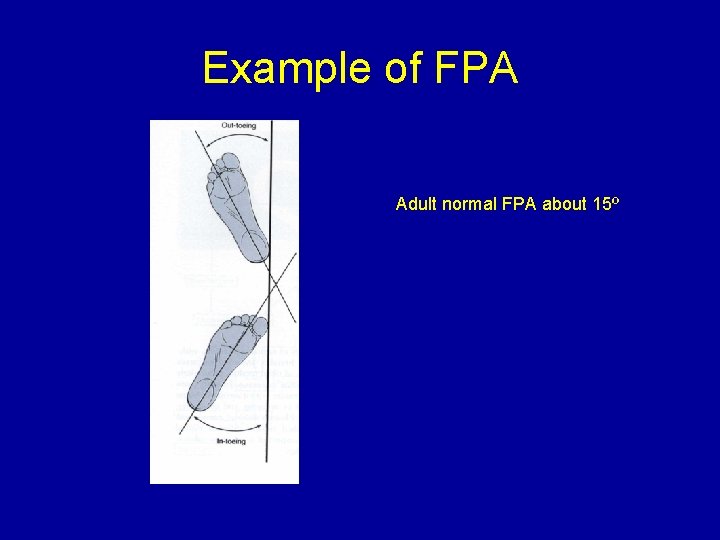 Example of FPA Adult normal FPA about 15º 
