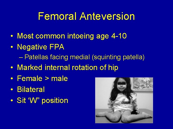 Femoral Anteversion • Most common intoeing age 4 -10 • Negative FPA – Patellas