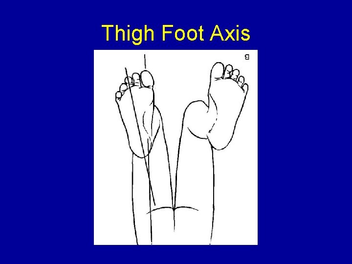 Thigh Foot Axis 