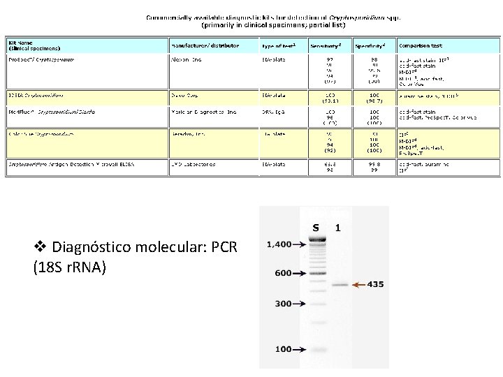 v Diagnóstico molecular: PCR (18 S r. RNA) 