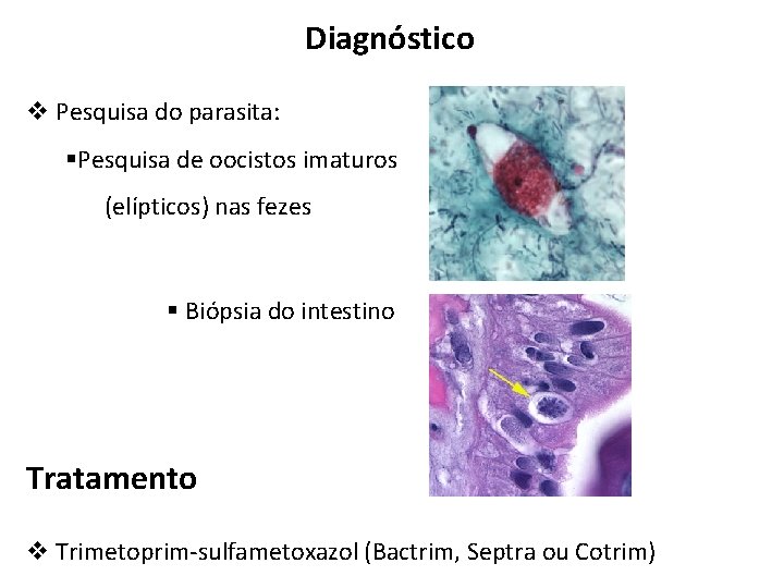 Diagnóstico v Pesquisa do parasita: §Pesquisa de oocistos imaturos (elípticos) nas fezes § Biópsia