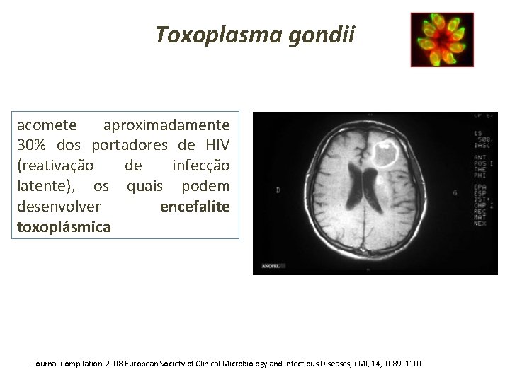 Toxoplasma gondii acomete aproximadamente 30% dos portadores de HIV (reativação de infecção latente), os