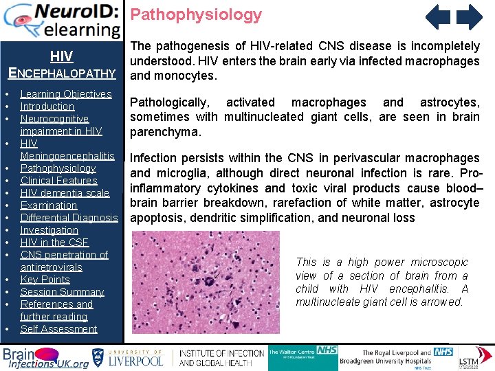 Pathophysiology HIV ENCEPHALOPATHY • • • • Learning Objectives Introduction Neurocognitive impairment in HIV