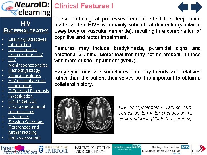 Clinical Features I HIV ENCEPHALOPATHY • • • • Learning Objectives Introduction Neurocognitive impairment