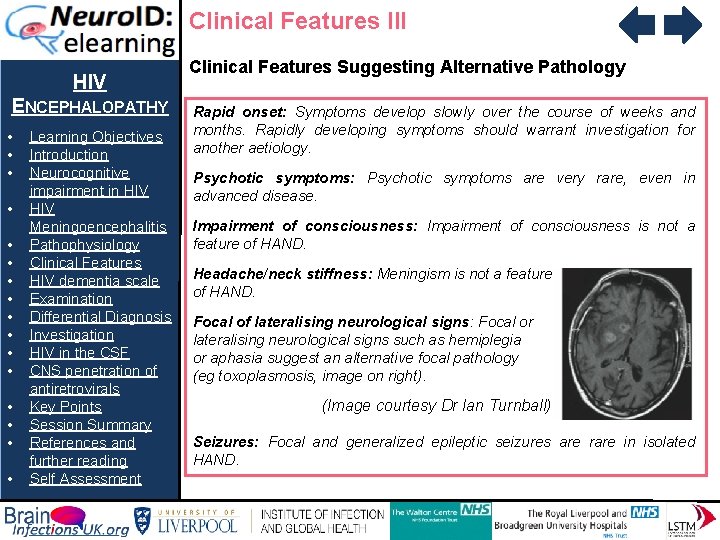 Clinical Features III HIV ENCEPHALOPATHY • • • • Learning Objectives Introduction Neurocognitive impairment