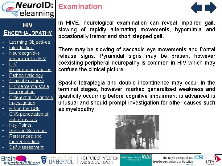 Examination HIV ENCEPHALOPATHY • • • • Learning Objectives Introduction Neurocognitive impairment in HIV