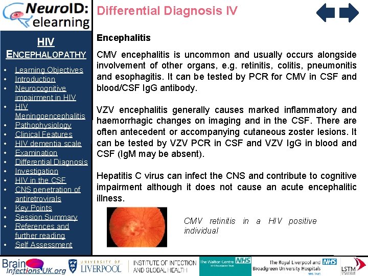 Differential Diagnosis IV HIV ENCEPHALOPATHY • • • • Learning Objectives Introduction Neurocognitive impairment