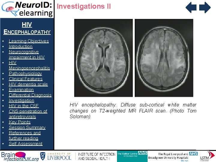 Investigations II HIV ENCEPHALOPATHY • • • • Learning Objectives Introduction Neurocognitive impairment in