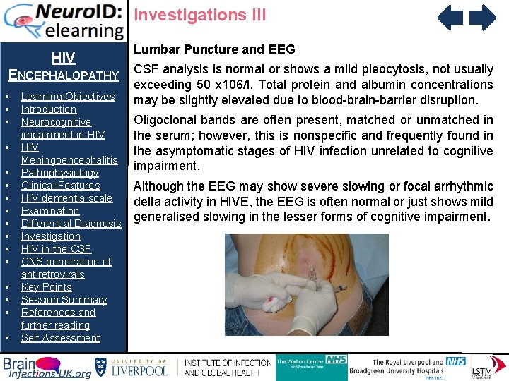 Investigations III HIV ENCEPHALOPATHY • • • • Learning Objectives Introduction Neurocognitive impairment in