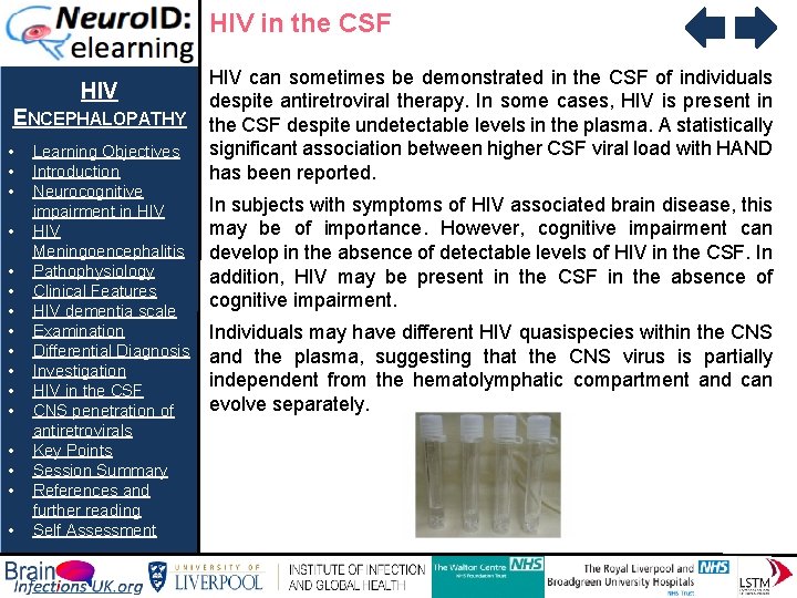 HIV in the CSF HIV ENCEPHALOPATHY • • • • Learning Objectives Introduction Neurocognitive