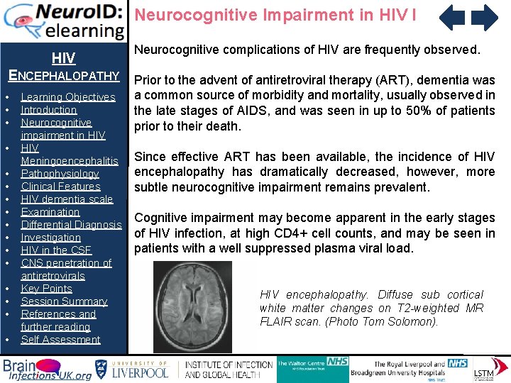 Neurocognitive Impairment in HIV I HIV ENCEPHALOPATHY • • • • Learning Objectives Introduction