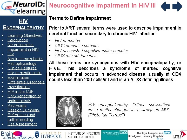 Neurocognitive Impairment in HIV III HIV ENCEPHALOPATHY • • • • Learning Objectives Introduction