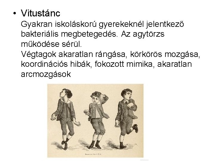  • Vitustánc Gyakran iskoláskorú gyerekeknél jelentkező bakteriális megbetegedés. Az agytörzs működése sérül. Végtagok