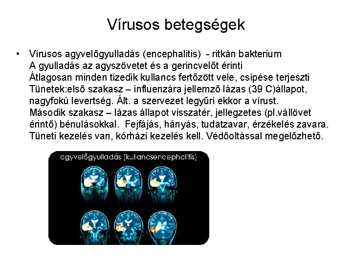 Vírusos betegségek • Vírusos agyvelőgyulladás (encephalitis) - ritkán bakterium A gyulladás az agyszövetet és