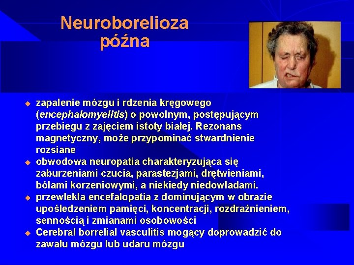 Neuroborelioza późna u u zapalenie mózgu i rdzenia kręgowego (encephalomyelitis) o powolnym, postępującym przebiegu