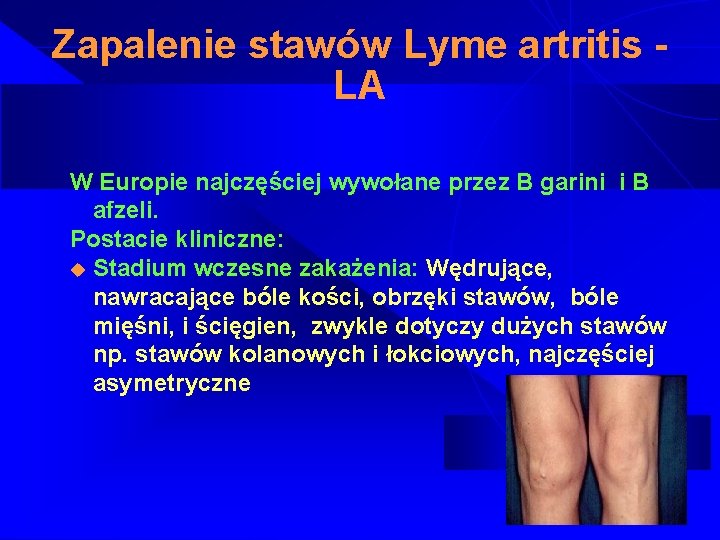 Zapalenie stawów Lyme artritis LA W Europie najczęściej wywołane przez B garini i B