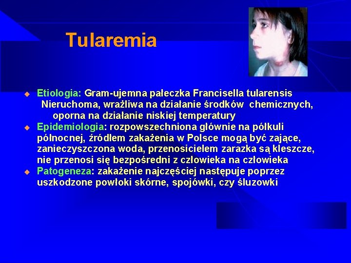 Tularemia u u u Etiologia: Gram-ujemna pałeczka Francisella tularensis Nieruchoma, wrażliwa na działanie środków