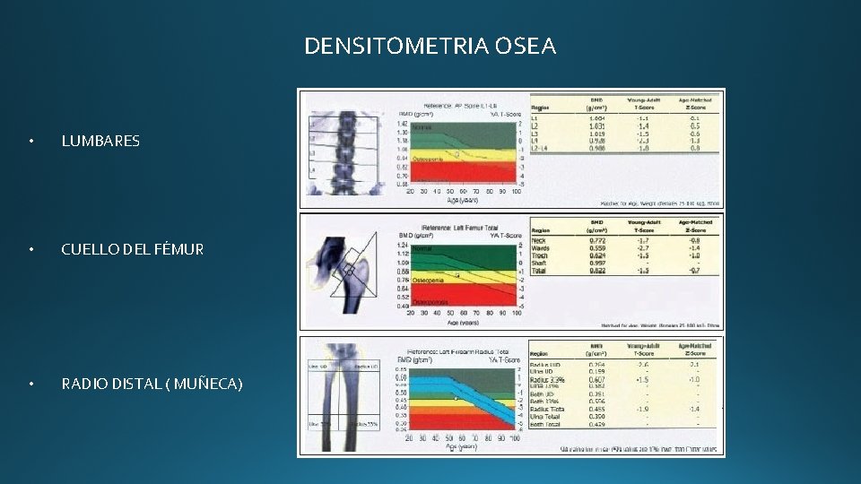 DENSITOMETRIA OSEA • LUMBARES • CUELLO DEL FÉMUR • RADIO DISTAL ( MUÑECA) DENSITOMETRIA OSEA • LUMBARES • CUELLO DEL FÉMUR • RADIO DISTAL ( MUÑECA)