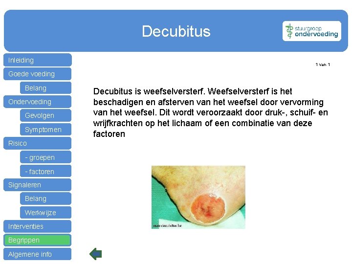 Decubitus Inleiding 1 van 1 Goede voeding Belang Ondervoeding Gevolgen Symptomen Risico - groepen