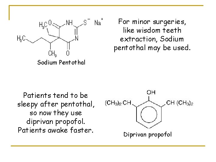 For minor surgeries, like wisdom teeth extraction, Sodium pentothal may be used. Sodium Pentothal