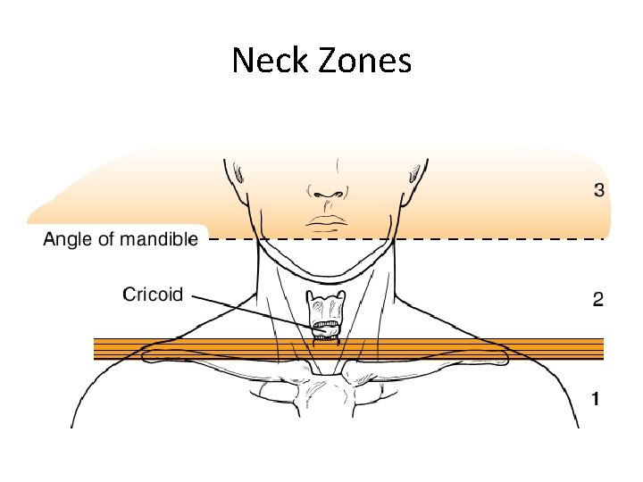 Neck Zones 