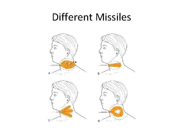 Different Missiles 