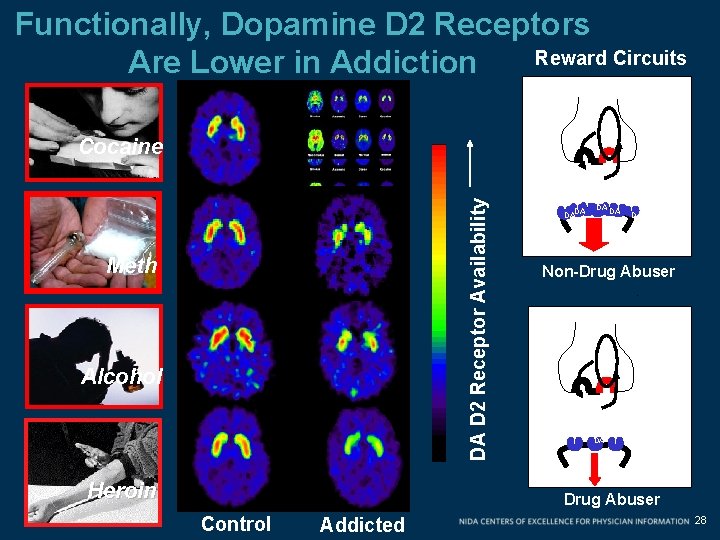 Functionally, Dopamine D 2 Receptors Reward Circuits Are Lower in Addiction Cocaine DADA DA Functionally, Dopamine D 2 Receptors Reward Circuits Are Lower in Addiction Cocaine DADA DA