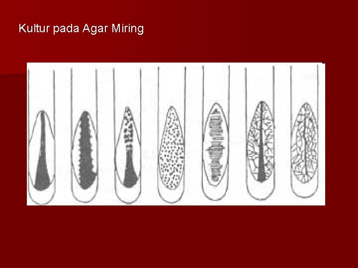 Kultur pada Agar Miring 