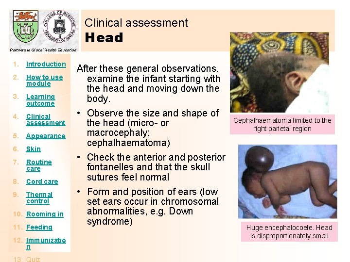Clinical assessment Head Partners in Global Health Education 1. Introduction 2. How to use