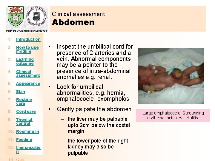 Clinical assessment Abdomen Partners in Global Health Education 1. Introduction 2. How to use