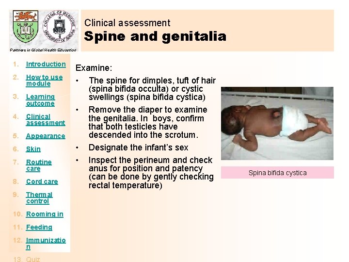 Clinical assessment Spine and genitalia Partners in Global Health Education 1. Introduction 2. How