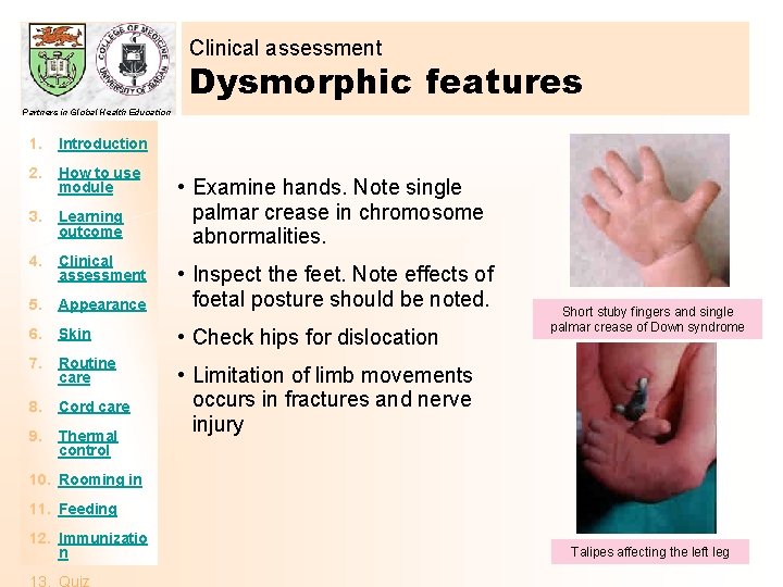 Clinical assessment Dysmorphic features Partners in Global Health Education 1. Introduction 2. How to