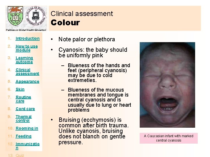 Clinical assessment Colour Partners in Global Health Education 1. Introduction 2. How to use
