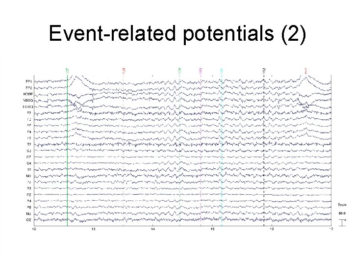 Event-related potentials (2) 